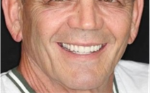 Tooth Extraction Sun City West | Geneva Dental Group | Patient 1 After